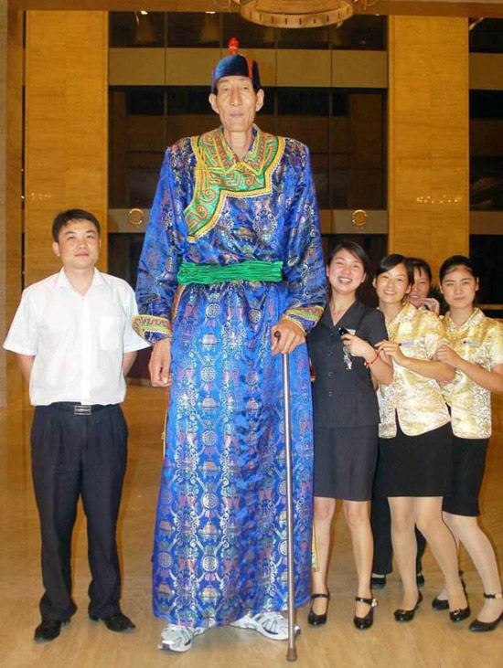 鲍喜顺，身高2.36米。他在15岁突然开始疯长起来，并且长到了1.89米，20岁那年，已经有2.1米左。虽然是巨人，但拥有有漂亮的妻子和健康的孩子。